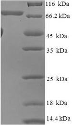 Recombinant Human RAC-beta serine/threonine-protein kinase (AKT2)