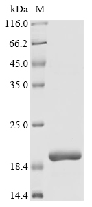 Recombinant Human AP-3 complex subunit beta-2 (AP3B2), partial