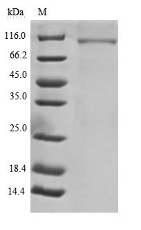 Recombinant Human B-cell receptor CD22 (CD22), partial (Active)