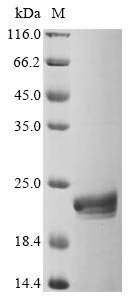 Recombinant Human Programmed cell death 1 ligand 1 (CD274), partial