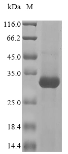 Recombinant Human Ceruloplasmin (CP), partial