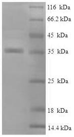 Recombinant Human Alpha-crystallin B chain (CRYAB)