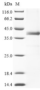Recombinant Human DNA cross-link repair 1A protein (DCLRE1A), partial
