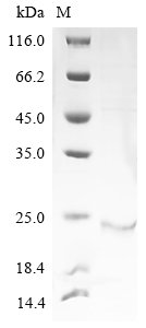 Recombinant Human Probable ATP-dependent RNA helicase DDX60 (DDX60), partial