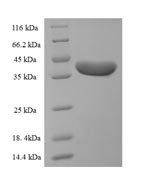 Recombinant Human Desmoplakin (DSP), partial