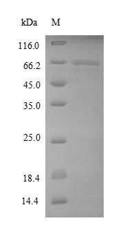 Recombinant Human Elongation factor 1-alpha 1 (EEF1A1)