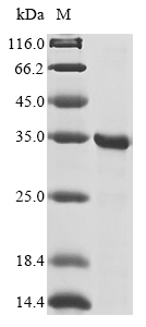 Recombinant Human Egl nine homolog 1 (EGLN1), partial
