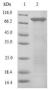 Recombinant Human Eukaryotic translation initiation factor 3 subunit E (EIF3E)