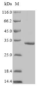 Recombinant Human Protein FAM167A (FAM167A)