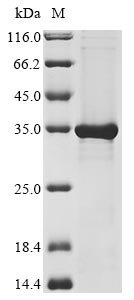 Recombinant Human F-box only protein 44 (FBXO44)