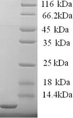 Recombinant Human High affinity immunoglobulin epsilon receptor subunit gamma (FCER1G), partial