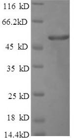 Recombinant Human FGA protein (FGA), partial