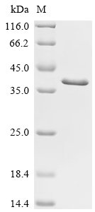 Recombinant Human Vigilin (HDLBP), partial