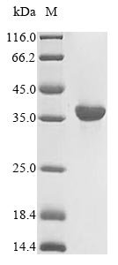 Recombinant Human HLA class I histocompatibility antigen, A alpha chain (HLA-A), partial