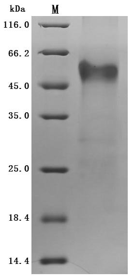 Recombinant Human IGF-like family receptor 1 (IGFLR1), partial (Active)