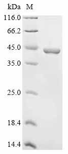 Recombinant Human Integrin beta-4 (ITGB4), partial