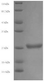 Recombinant Human Killer cell immunoglobulin-like receptor 2DS1 (KIR2DS1), partial