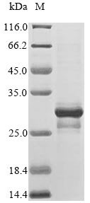 Recombinant Human Melanoma antigen recognized by T-cells 1 (MLANA)