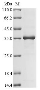 Recombinant Human Myeloid differentiation primary response protein MyD88 (MYD88)