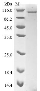 Recombinant Human Nuclear cap-binding protein subunit 1 (NCBP1)