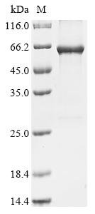 Recombinant Human Serine/threonine-protein kinase NLK (NLK)