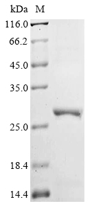 Recombinant Human Oxysterols receptor LXR-beta (NR1H2), partial
