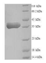 Recombinant Human Pro-neuregulin-2, membrane-bound isoform (NRG2), partial