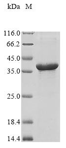 Recombinant Human Non-structural maintenance of chromosomes element 3 homolog (NSMCE3)