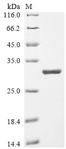 Recombinant Human 5' (3')-deoxyribonucleotidase, cytosolic type (NT5C)