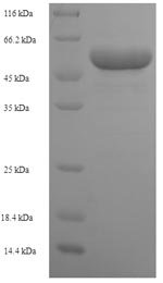 Recombinant Human Ribose-phosphate pyrophosphokinase 1 (PRPS1)