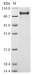 Recombinant Human Receptor-interacting serine/threonine-protein kinase 1 (RIPK1)