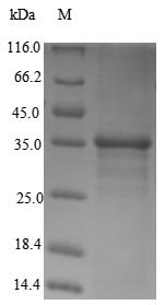 Recombinant Human Transcription activator BRG1 (SMARCA4), partial