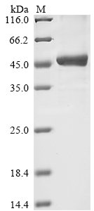 Recombinant Human Serine protease inhibitor Kazal-type 5 (SPINK5), partial