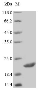 Recombinant Human Statherin (STATH)