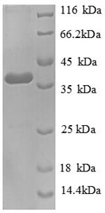 Recombinant Human Tenascin (TNC), partial