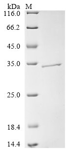 Recombinant African swine fever virus Uncharacterized protein K145R