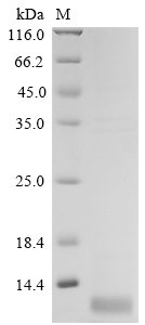 Recombinant Avian infectious bronchitis virus Non-structural protein 3b (3b)