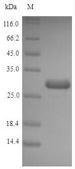 Recombinant Escherichia coli Acyl carrier protein (acpP)