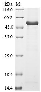 Recombinant Rat Angiopoietin-2 (Angpt2)