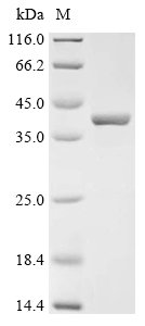 Recombinant Coxiella burnetii Bis (5’-nucleosyl)-tetraphosphatase, symmetrical (apaH)