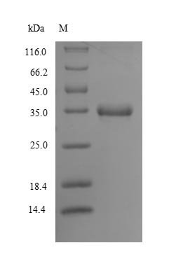 Recombinant Caenorhabditis elegans Beta carbonic anhydrase 1 (bca-1)