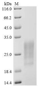 Recombinant Camelpox virus Protein OPG161 (CMP150R), partial