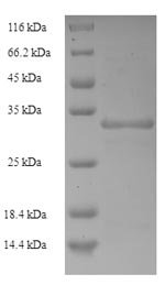 Recombinant Escherichia coli CS6 fimbrial subunit B (cssB)
