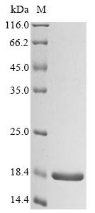 Recombinant Mycobacterium tuberculosis ESX-1 secretion-associated protein EspK (espK), partial