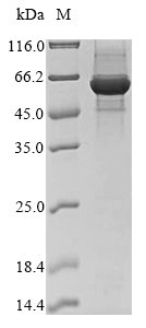 Recombinant Bovine Ferrochelatase, mitochondrial (FECH)