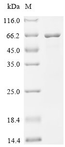 Recombinant Mycobacterium tuberculosis Glutamine synthetase (glnA1)