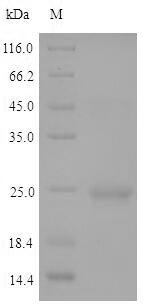 Recombinant Arabidopsis thaliana Histone deacetylase HDT2 (HDT2)