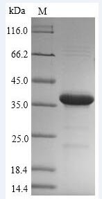 Recombinant Mycobacterium tuberculosis Hypoxic response protein 1 (hrp1)