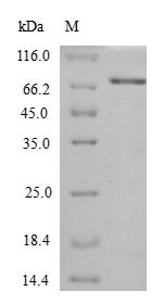 Recombinant Escherichia coli Chaperone protein HtpG (htpG)