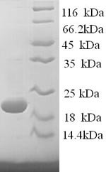 Recombinant Sheep Interferon gamma (IFNG)